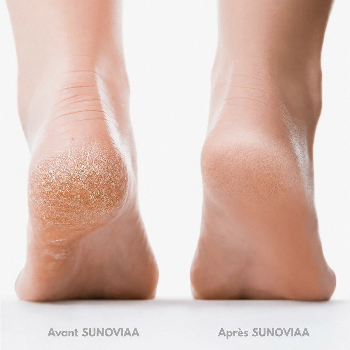 SUNOVIAA Silk 3 Pro